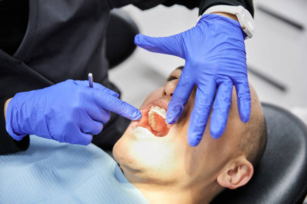 Best Emergency Root Canal Treatment in Conyers, GA