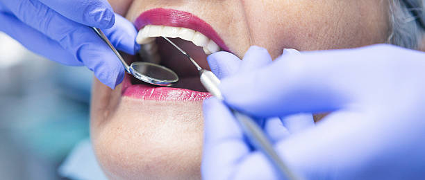 Best Emergency Dental Extractions in Conyers, GA