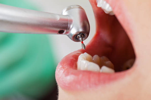 Best Holiday Emergency Dentist in Conyers, GA